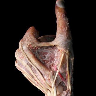 Общая Хирургия