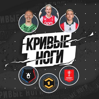 Кривые Ноги