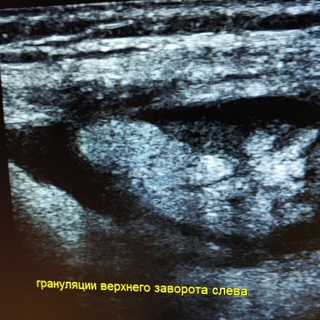 US General Imaging