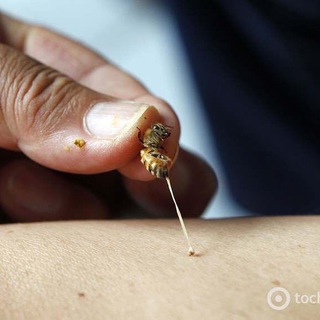 Апитерапия ЧР. 95