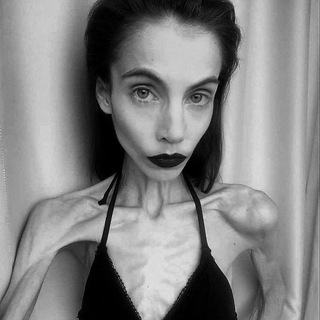 ЧБ расстройство