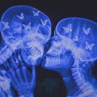 🦋Бабочки в голове🦋