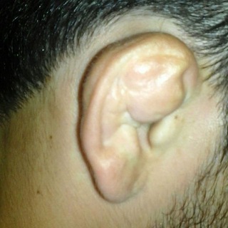 Ушной мастер👊