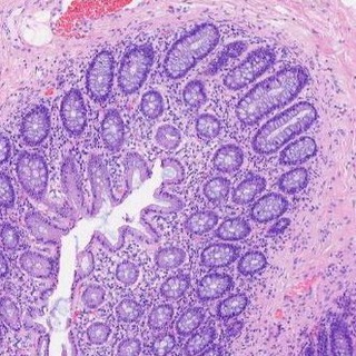 гисто логично