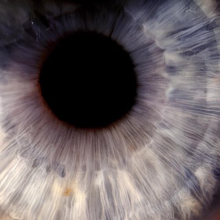 гиперфиксация