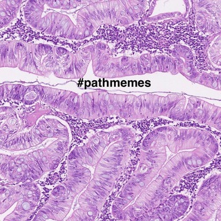 #pathmemes