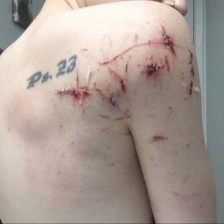 приступ интроверта